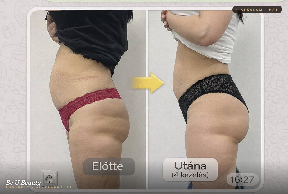 Előtte-utána